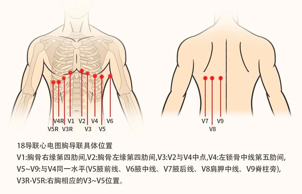 怎么拉心电图(怎么拉心电图检查什么)